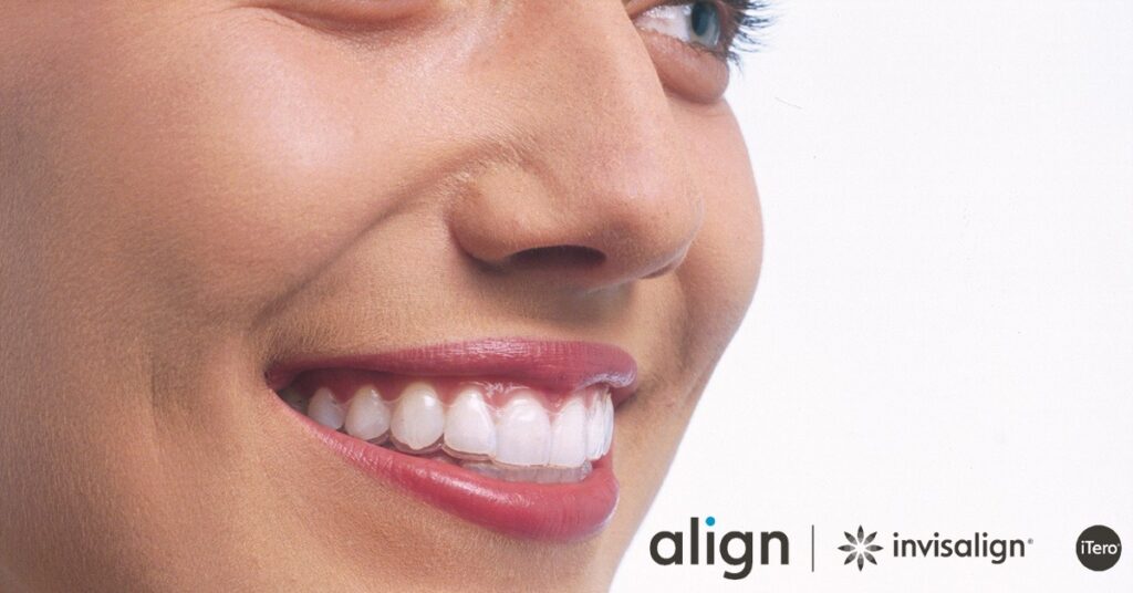 Allineatori Invisibili: Funzionano Davvero? | Wedental Care - Foto 6